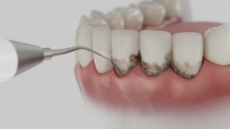 Reliable Invisalign Clear Aligners contractor in Winchester, CA by Smile Center Dentistry